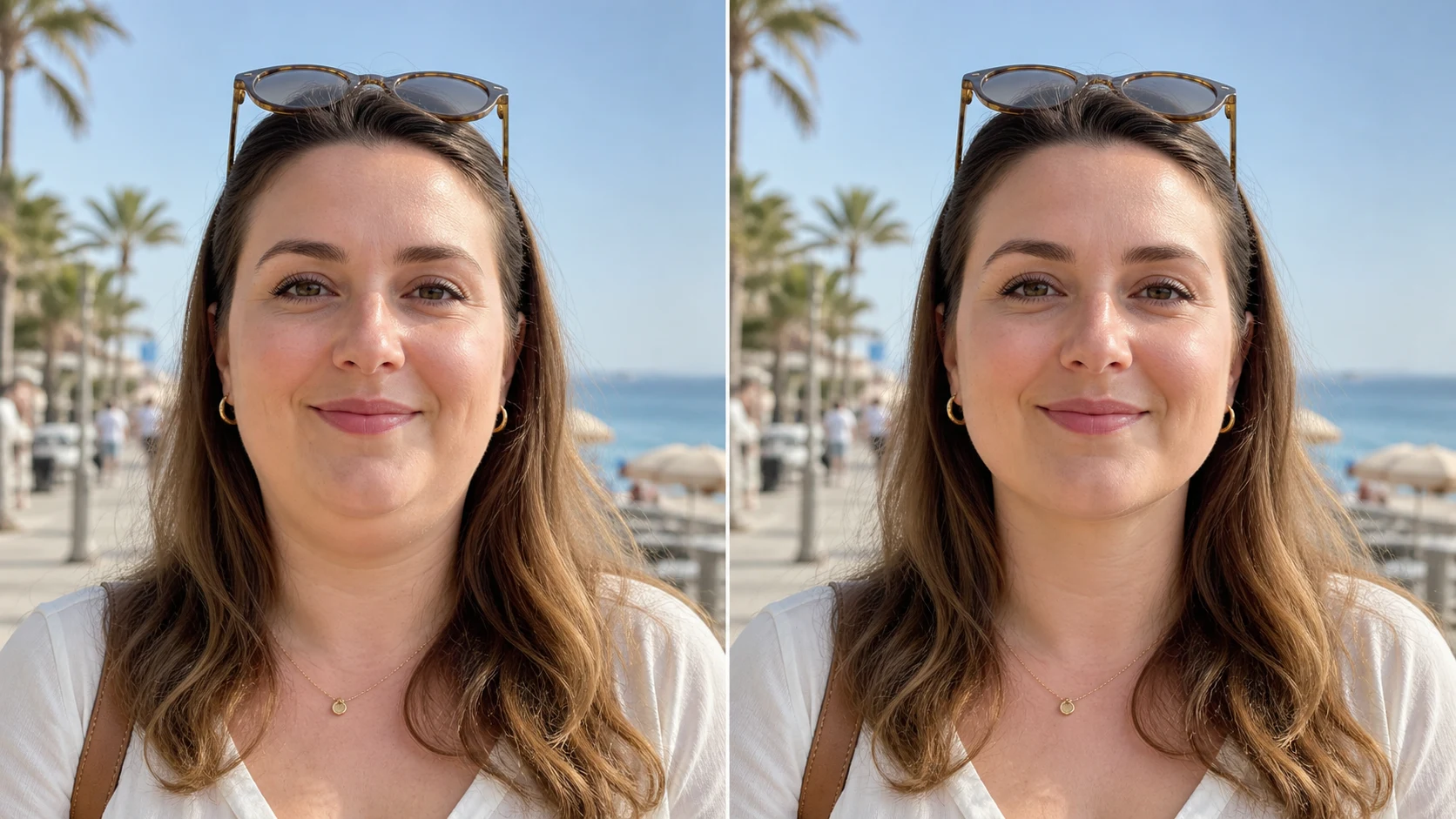 Before and after vacation picture showing remove double chin picture result